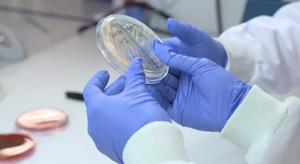 Antimicrobial Medical Gloves