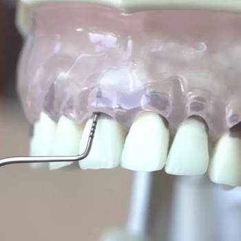 Dental Imaging