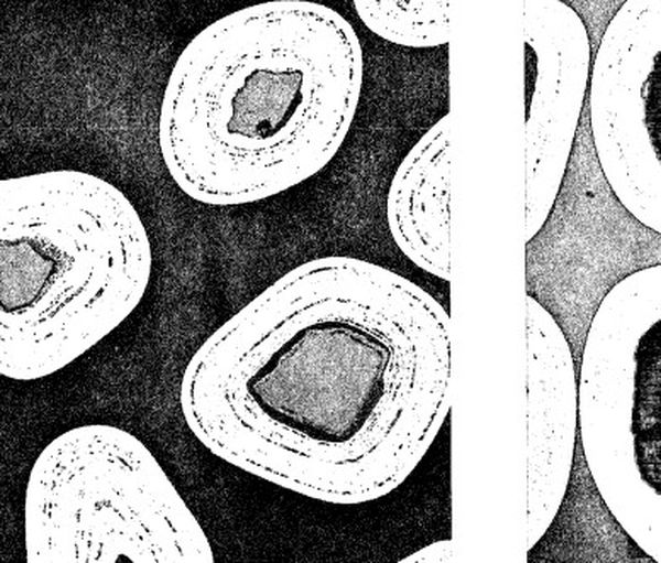 Pyrolitic Carbon Coatings