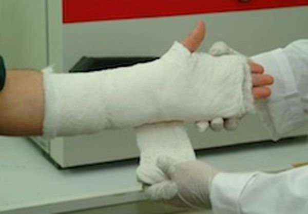 Pre-deposited blade in a plaster cast