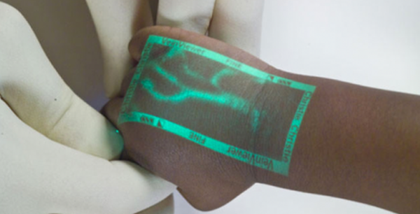 Veinviewer