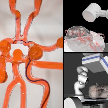 MIT Surgical Robot