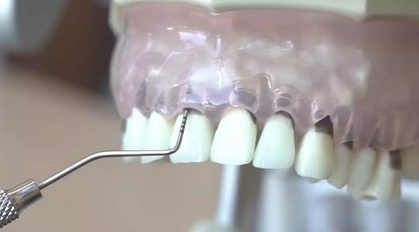 Dental Imaging
