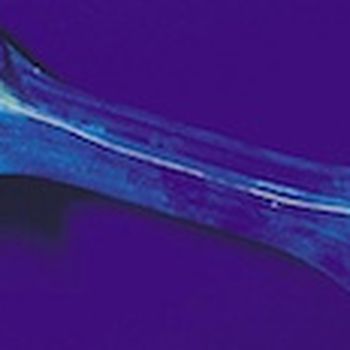 UV as a non destructive crack detection method