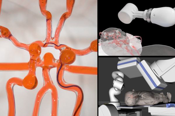 MIT Surgical Robot