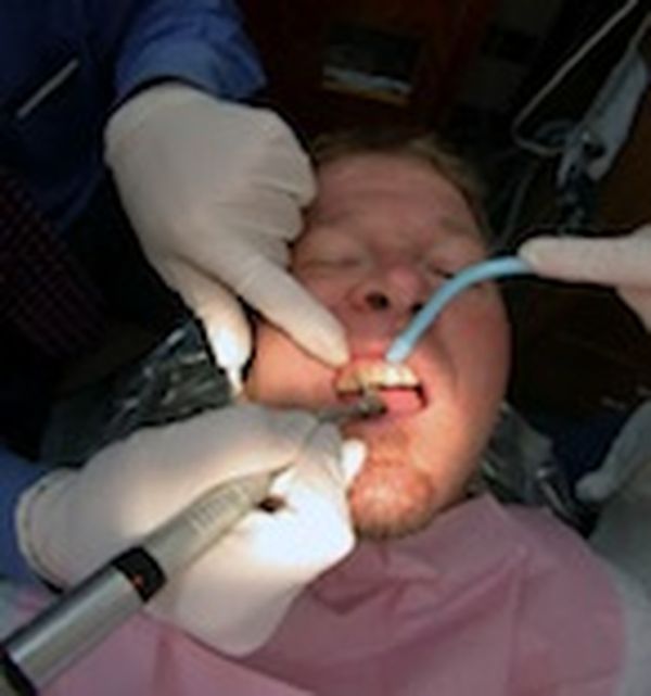 Dentist drill