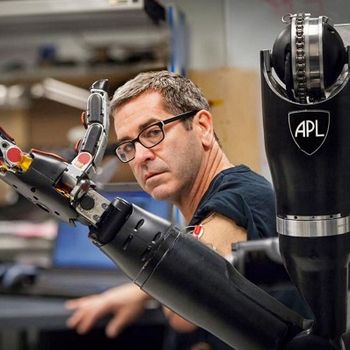 Modular Prosthetic Limb
