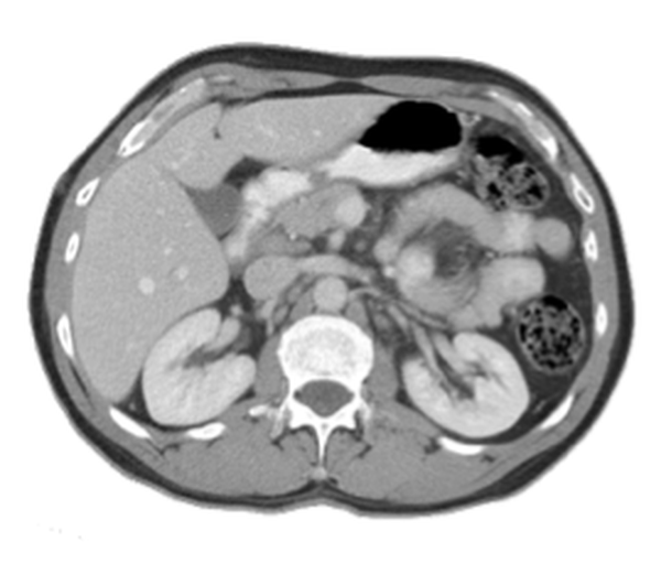 X-Ray Tomography
