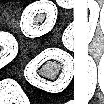 Pyrolitic Carbon Coatings