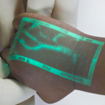 Veinviewer
